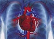  После инфаркта может появиться кардиогенный шок