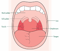 опухоль полости рта
